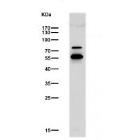 Choline Acetyltransferase Rabbit mAb