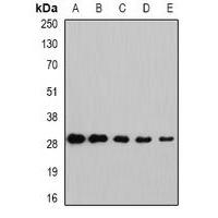 NNMT Antibody