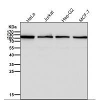 NF kappa B p100 Rabbit mAb