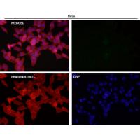 Tissue Factor Rabbit mAb