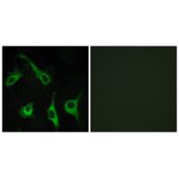 EDG-1 Polyclonal Antibody