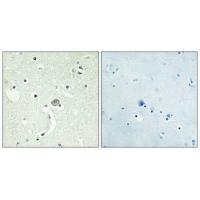 EDG-1 Polyclonal Antibody