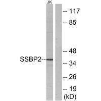 SSBP2 Polyclonal Antibody