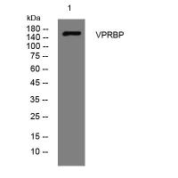 VPRBP rabbit pAb