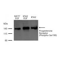 Progesterone Receptor(Phospho-Ser190) Antibody