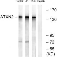 Ataxin-2 Polyclonal Antibody