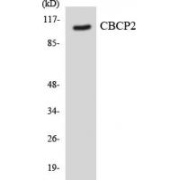 CCP2 Polyclonal Antibody