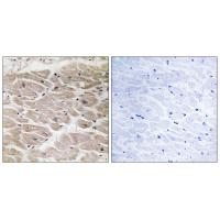 CCP2 Polyclonal Antibody