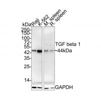 TGF-Beta 1 Antibody