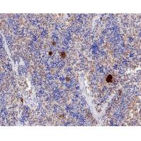 TGF-Beta 1 Antibody