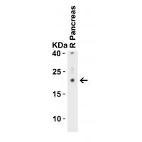 CCDC69 Antibody