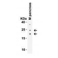 CCDC69 Antibody