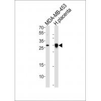 FOLR2 Rabbit Polyclonal Antibody (N-term)