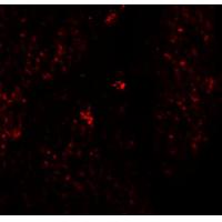 RHAMM Antibody