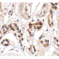 UHRF1BP1 Antibody