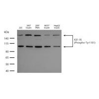 IGF-1R(Phospho-Tyr1161) Antibody