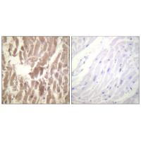 TNNI3 (Phospho-Ser43) Antibody