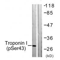 TNNI3 (Phospho-Ser43) Antibody