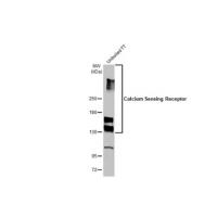 Calcium Sensing Receptor Antibody