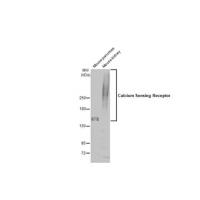 Calcium Sensing Receptor Antibody