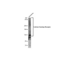 Calcium Sensing Receptor Antibody