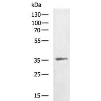 SIGLEC15 Antibody