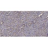 TRIM28(phospho-Ser824) Antibody