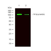 TRIM28(phospho-Ser824) Antibody