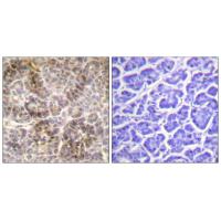 Ezrin/Radixin/Moesin (phospho-Thr567/564/558) Antibody 