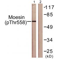 Ezrin/Radixin/Moesin (phospho-Thr567/564/558) Antibody 