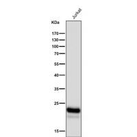 CD3D Rabbit mAb