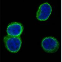 CD3D Rabbit mAb