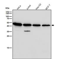 CXCR5 Rabbit mAb