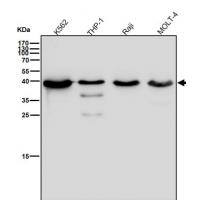 CXCR5 Rabbit mAb