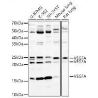 VEGF Rabbit Polyclonal Antibody