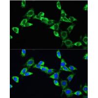 VEGF Rabbit Polyclonal Antibody