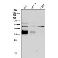 Legumain Rabbit mAb