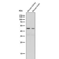 Legumain Rabbit mAb