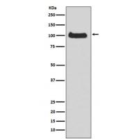 PKD1 Rabbit mAb