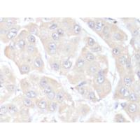 F7 Antibody