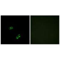 MC5R antibody