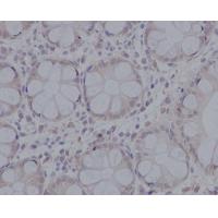 pro Caspase 3 Rabbit mAb