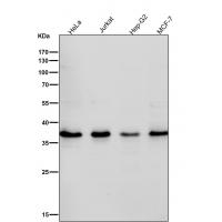 Rad51 Rabbit mAb