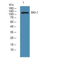 SKI-1 Polyclonal Antibody