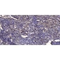 SKI-1 Polyclonal Antibody