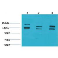 BAI1 Polyclonal Antibody