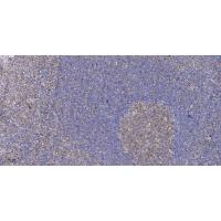 MIPP Polyclonal Antibody