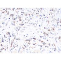 FOXF2 Antibody