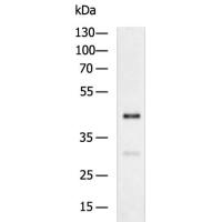 FOXF2 Antibody