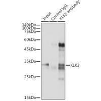 KLK3 antibody